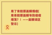用了骨胶原面膜爆痘(用骨胶原面膜导致痘痘爆发？！——面膜误区警示)