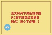 夏天肘关节黑色斑块图片(夏季肘部出现黑色斑点？担心不必要！)