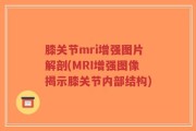 膝关节mri增强图片解剖(MRI增强图像揭示膝关节内部结构)