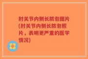 肘关节内侧长脓包图片(肘关节内侧长脓包照片，表明更严重的医学情况)