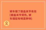 被车撞了膝盖关节有包(膝盖关节受伤, 被车撞后有明显肿块)