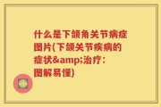 什么是下颌角关节病症图片(下颌关节疾病的症状&治疗：图解易懂)