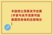 手部虎口发黑关节也黑(手掌与关节发黑可能暴露你身体的这些暗示)