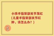 小孩手指背部关节发红(儿童手指背部关节红肿，该怎么办？)