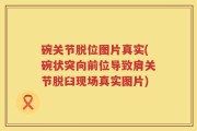 碗关节脱位图片真实(碗状突向前位导致肩关节脱臼现场真实图片)