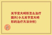 关节宽大畸形怎么治疗图片(小儿关节宽大畸形的治疗方法分析)