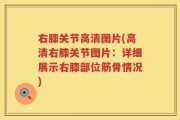 右膝关节高清图片(高清右膝关节图片：详细展示右膝部位筋骨情况)