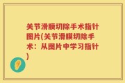 关节滑膜切除手术指针图片(关节滑膜切除手术：从图片中学习指针)