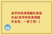 关节外伤渗液图片真实大全(关节外伤渗液图片全览，一目了然！)