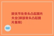 脚关节处骨头凸起图片大全(脚部骨头凸起图片集锦)