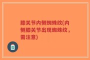 膝关节内侧蜘蛛纹(内侧膝关节出现蜘蛛纹，需注意)