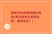 腿关节灰色斑块图片男生(男生腿关节出现灰斑，值得关注！)