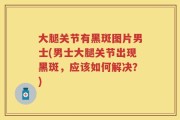 大腿关节有黑斑图片男士(男士大腿关节出现黑斑，应该如何解决？)