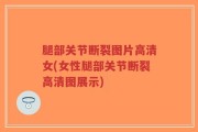 腿部关节断裂图片高清女(女性腿部关节断裂高清图展示)