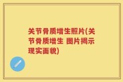 关节骨质增生照片(关节骨质增生 图片揭示现实面貌)