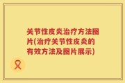 关节性皮炎治疗方法图片(治疗关节性皮炎的有效方法及图片展示)