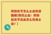 摔倒关节怎么止血快速图解(教你止血！摔倒后关节出血怎么快速止血？)