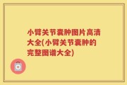 小臂关节囊肿图片高清大全(小臂关节囊肿的完整图谱大全)