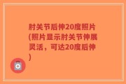 肘关节后伸20度照片(照片显示肘关节伸展灵活，可达20度后伸)