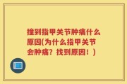 撞到指甲关节肿痛什么原因(为什么指甲关节会肿痛？找到原因！)