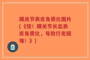 踝关节表皮角质化图片(《惊！踝关节长出表皮角质化，导致行走困难！》)
