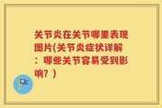 关节炎在关节哪里表现图片(关节炎症状详解：哪些关节容易受到影响？)