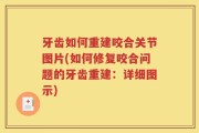 牙齿如何重建咬合关节图片(如何修复咬合问题的牙齿重建：详细图示)