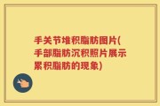 手关节堆积脂肪图片(手部脂肪沉积照片展示累积脂肪的现象)