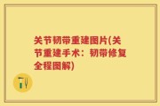 关节韧带重建图片(关节重建手术：韧带修复全程图解)