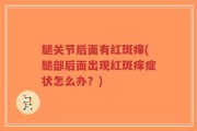 腿关节后面有红斑痒(腿部后面出现红斑痒症状怎么办？)