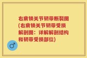 右肩锁关节韧带断裂图(右肩锁关节韧带受损解剖图：详解解剖结构和韧带受损部位)