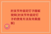 肘关节外固定钉子图解视频(肘关节外固定钉子的使用方法及效果图解)