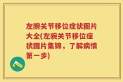 左腕关节移位症状图片大全(左腕关节移位症状图片集锦，了解病情第一步)