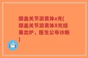 膝盖关节游离体x光(膝盖关节游离体X光结果出炉，医生公布诊断)