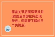 膝盖关节后面窝里鼓包(膝盖后窝部位突出现鼓包，你需要了解的三个关键点)