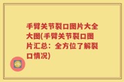 手臂关节裂口图片大全大图(手臂关节裂口图片汇总：全方位了解裂口情况)