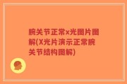 腕关节正常x光图片图解(X光片演示正常腕关节结构图解)