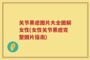 关节黑痣图片大全图解女性(女性关节黑痣完整图片指南)