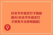 肘关节外固定钉子图解图片(肘关节外固定钉子使用方法简明图解)
