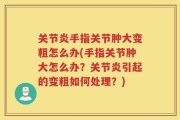 关节炎手指关节肿大变粗怎么办(手指关节肿大怎么办？关节炎引起的变粗如何处理？)