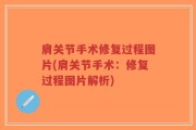 肩关节手术修复过程图片(肩关节手术：修复过程图片解析)