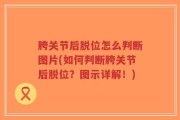 胯关节后脱位怎么判断图片(如何判断胯关节后脱位？图示详解！)