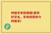 种植牙骨胶原图(重现好牙齿，牙骨胶原助力种植牙)