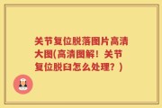 关节复位脱落图片高清大图(高清图解！关节复位脱臼怎么处理？)