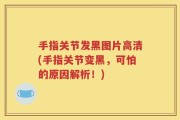 手指关节发黑图片高清(手指关节变黑，可怕的原因解析！)