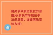 肩关节半脱位复位方法图片(肩关节半脱位手法示意图，详细演示复位方法)