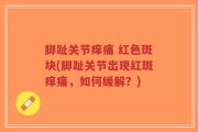 脚趾关节痒痛 红色斑块(脚趾关节出现红斑痒痛，如何缓解？)