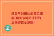 腕关节封闭注射部位图解(腕关节封闭注射的正确部位示意图)