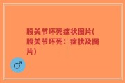 股关节坏死症状图片(股关节坏死：症状及图片)