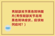 男腿部关节黑色斑块图片(男性腿部关节出现黑色斑块症状，应该如何应对？)